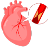 heart diseases